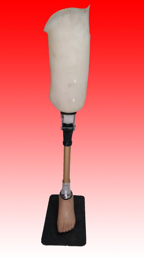 Kaki Palsu Atas Lutut